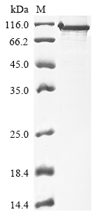 Human PPP1R15A protein