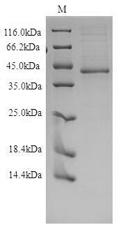 Human EDNRB protein