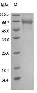 Human TNFRSF1B protein