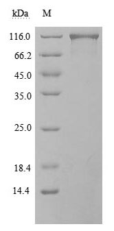 Human ACE2 protein