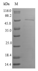 Human IP6K1 protein