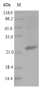 Bacterial hupB protein