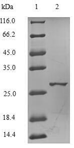 Human COMT protein