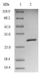 Human BIRC5 protein