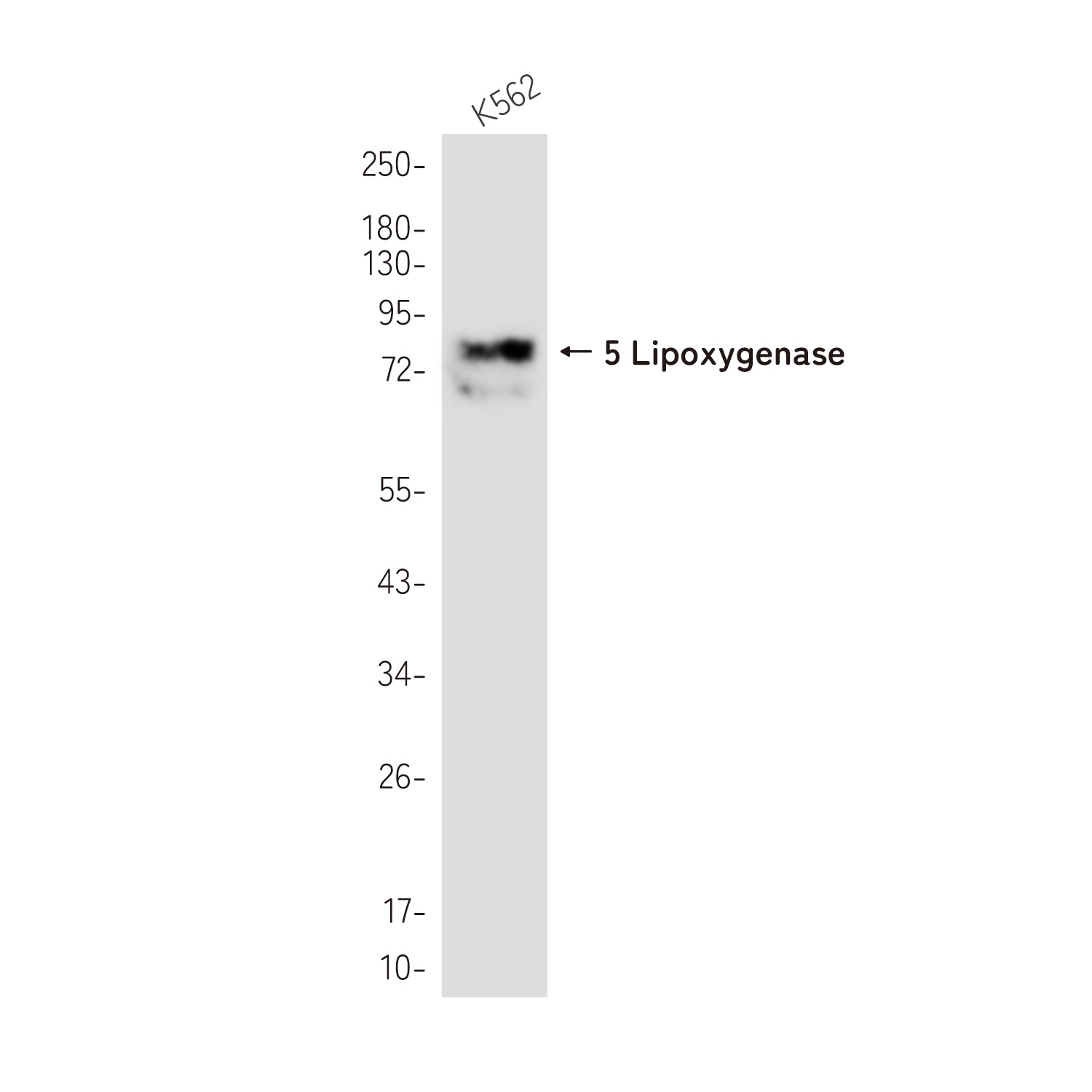 5 Lipoxygenase Rabbit mAb