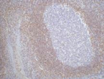 Bcl2 (3H5) Mouse mAb