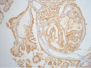Galectin 3 (4B2) Mouse mAb