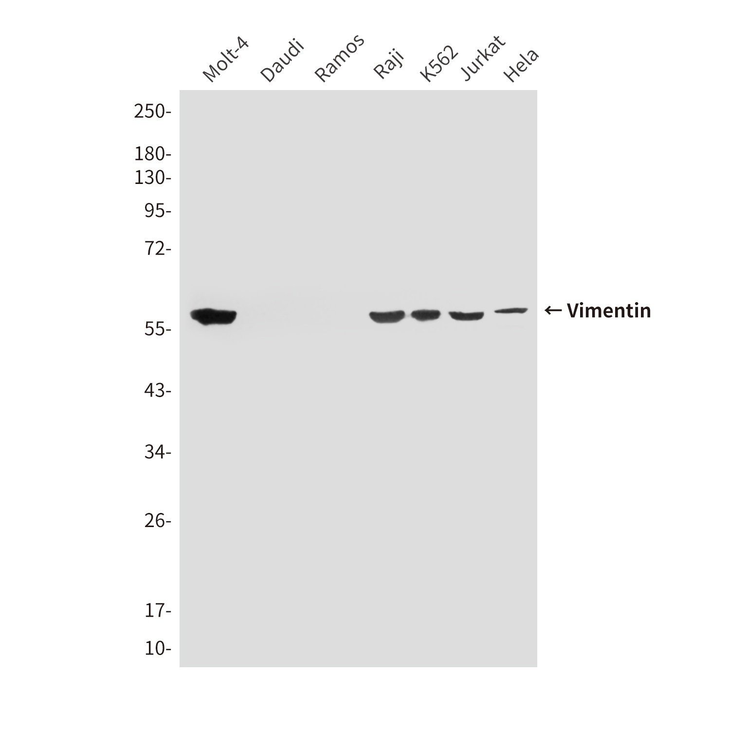 Vimentin (4F8) Mouse mAb