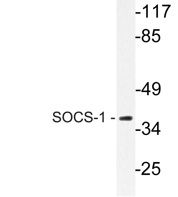 SOCS1 Rabbit pAb