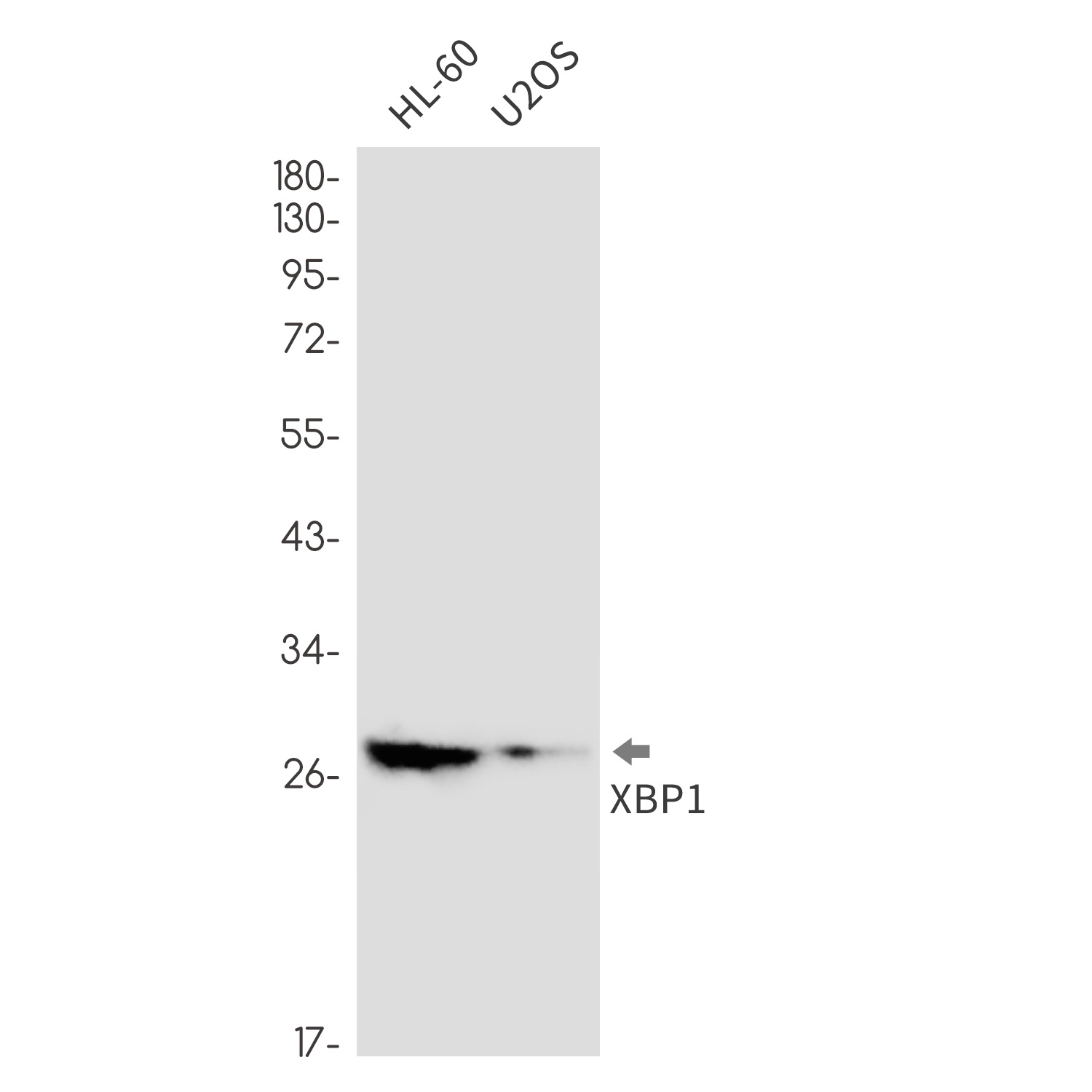 XBP1 Rabbit mAb