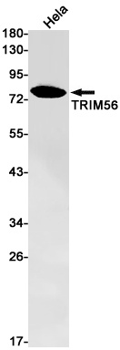 TRIM56 Antibody