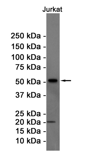 [KD] Cyclin B1 Rabbit mAb