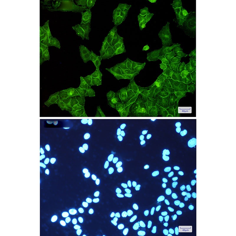 [KO] EGFR Rabbit mAb