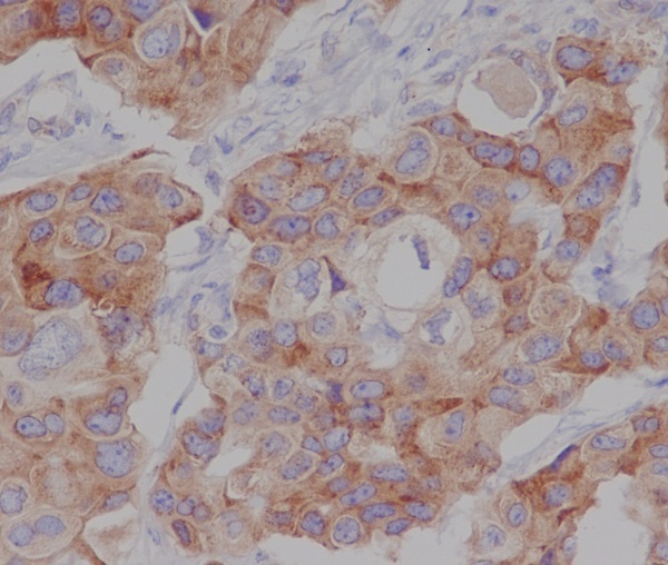 Phospho-mTOR (Ser2448) Rabbit pAb