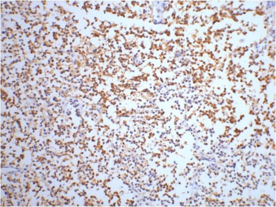 NSE (4C7) Mouse mAb