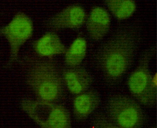 DNA PKcs (8D3) Mouse mAb