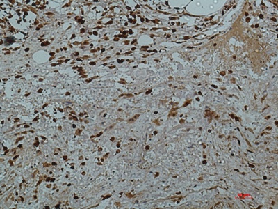 Galectin 3 (7G9) Mouse mAb