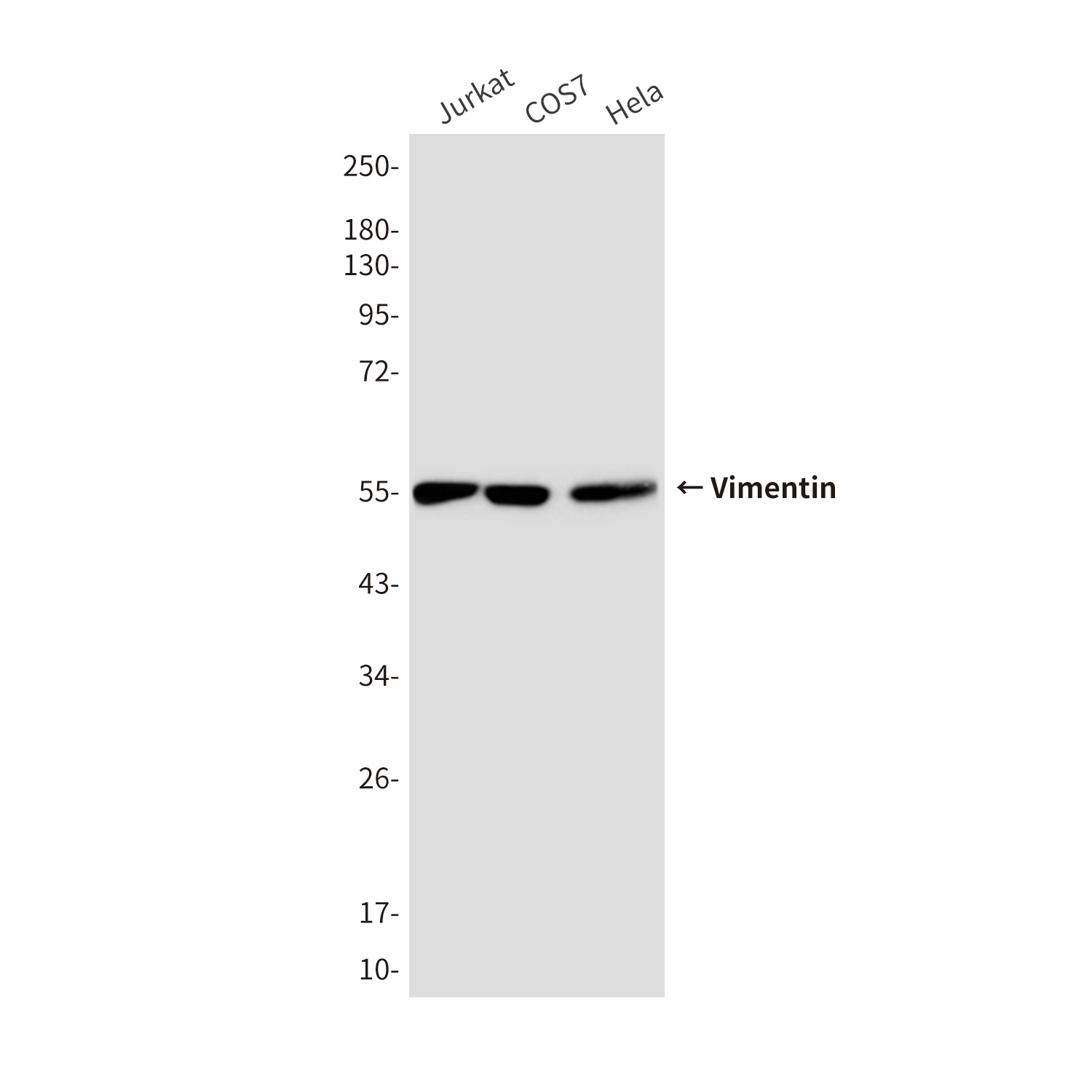 Vimentin (10E2) Mouse mAb