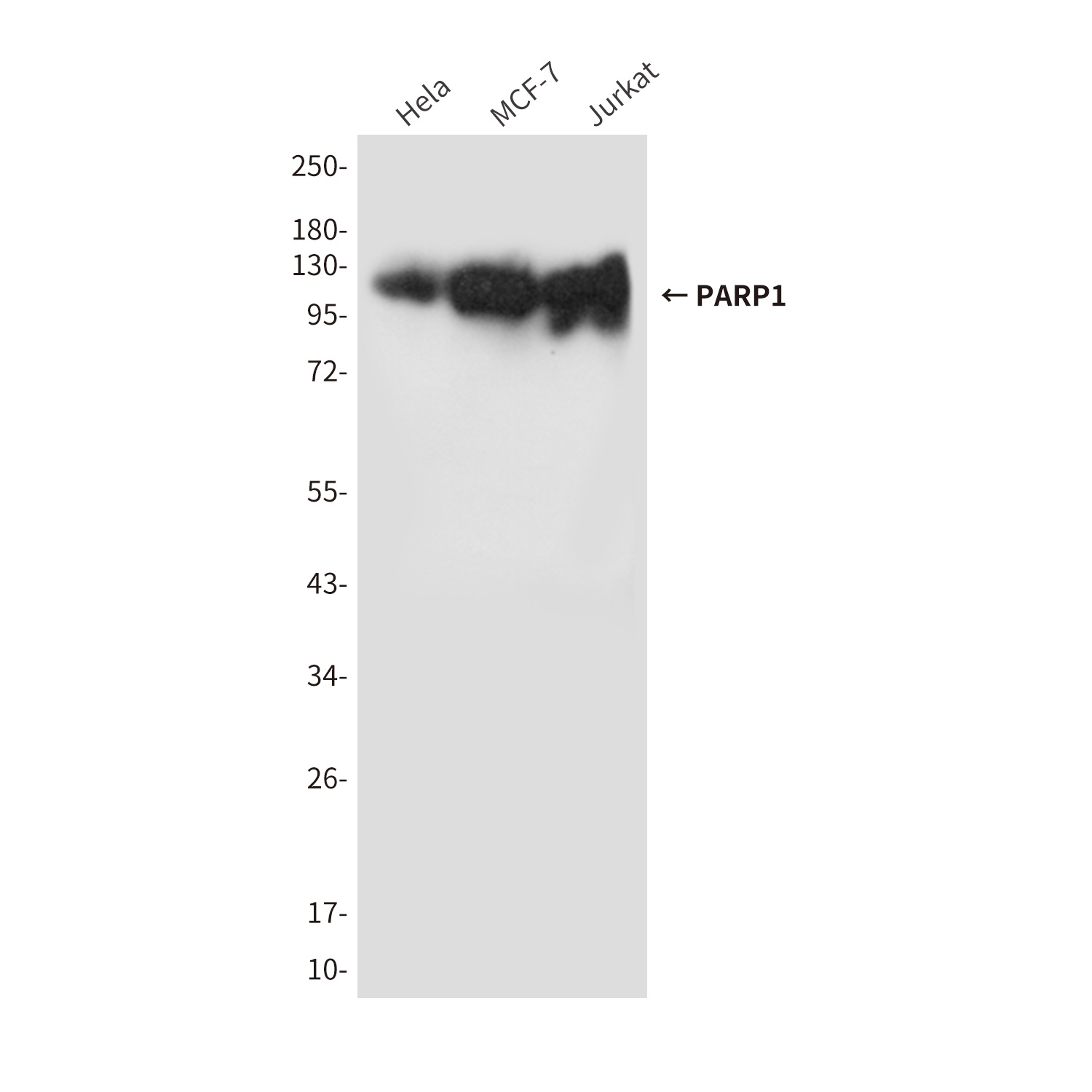 PARP1 (10C2) Mouse mAb