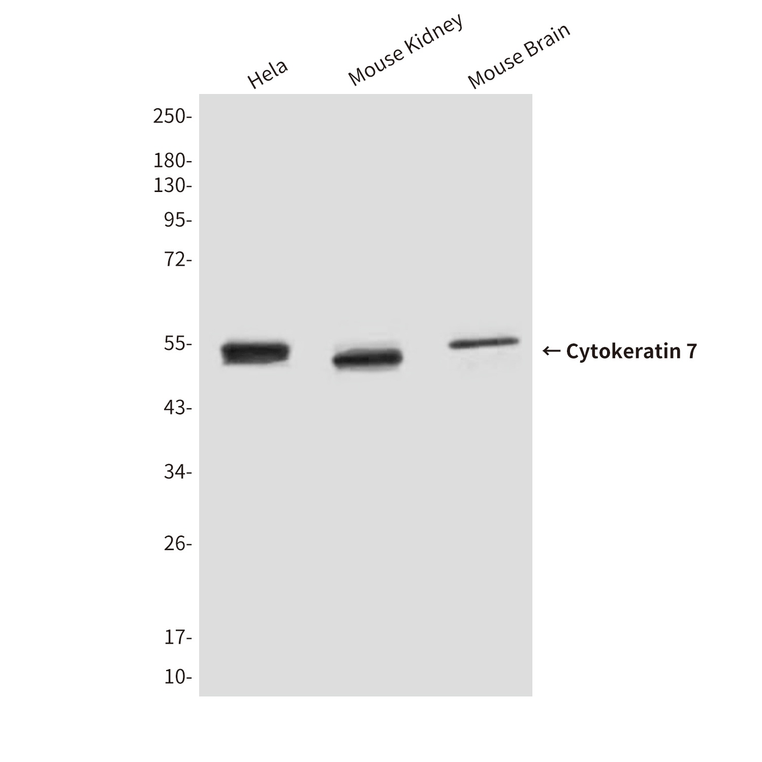 Cytokeratin 7 (9G9) Mouse mAb