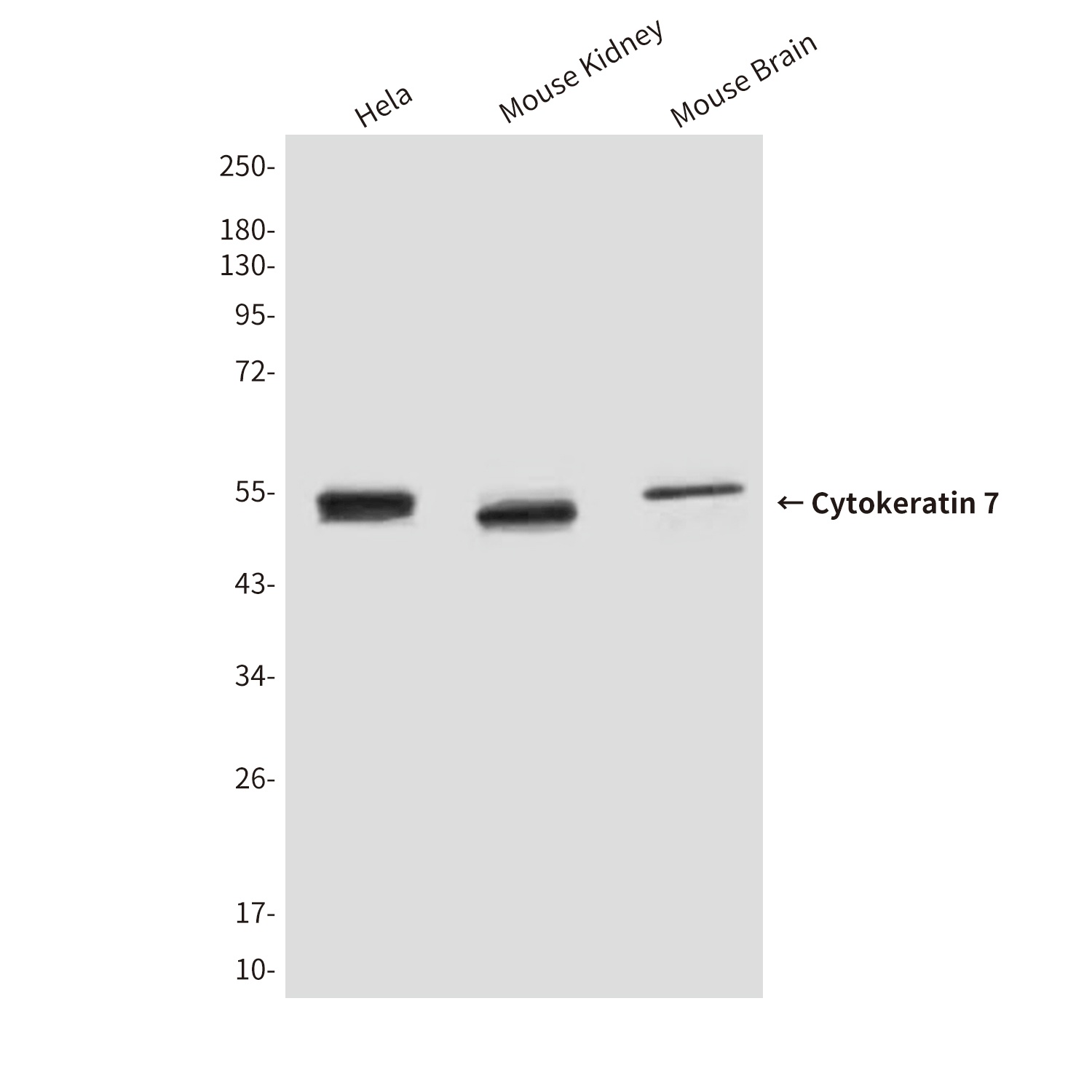 KRT7 Antibody