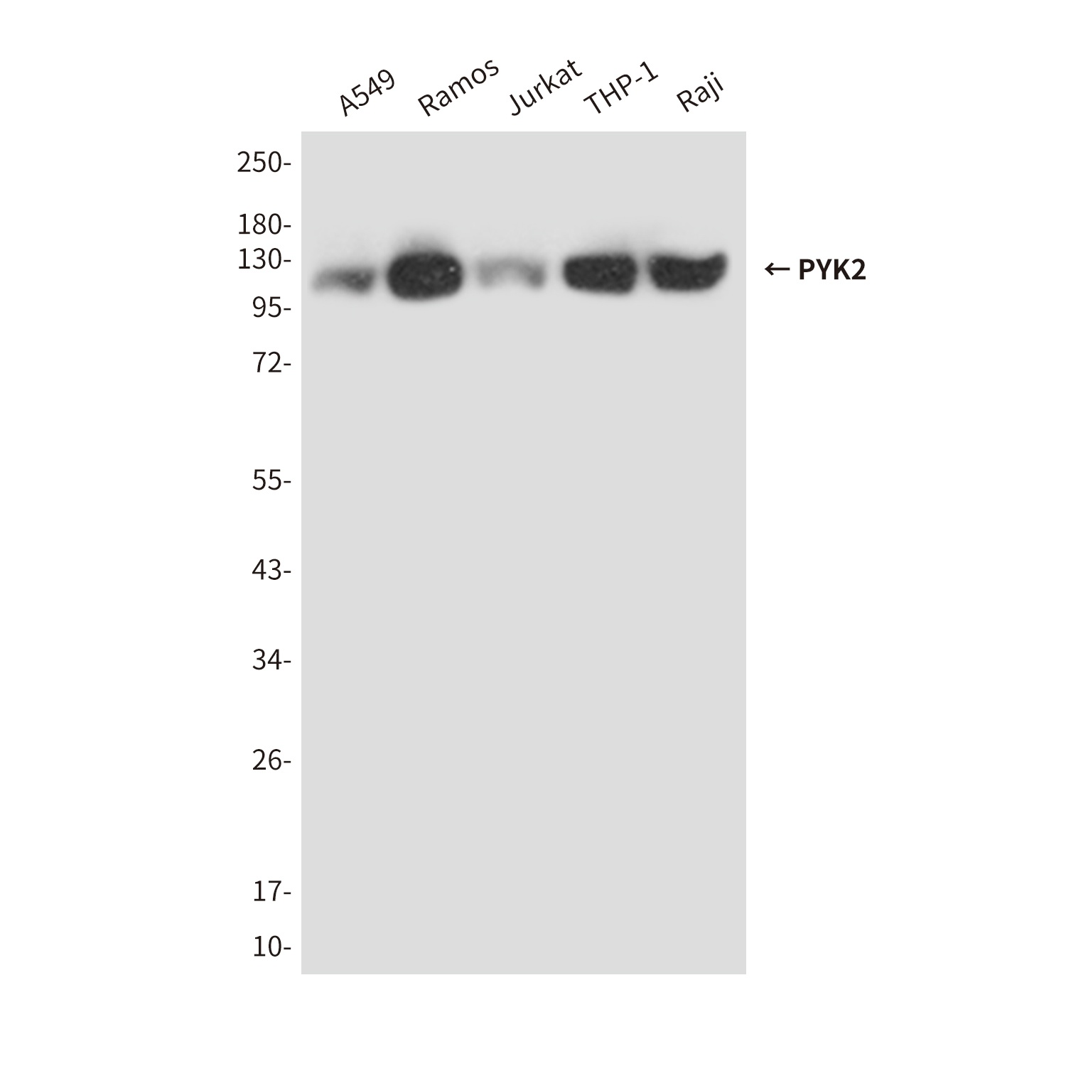PYK2 (4B4) Mouse mAb