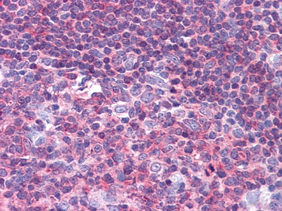 PYK2 (4B4) Mouse mAb