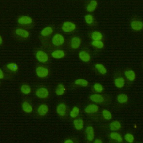 FEN1 (7H8) Mouse mAb