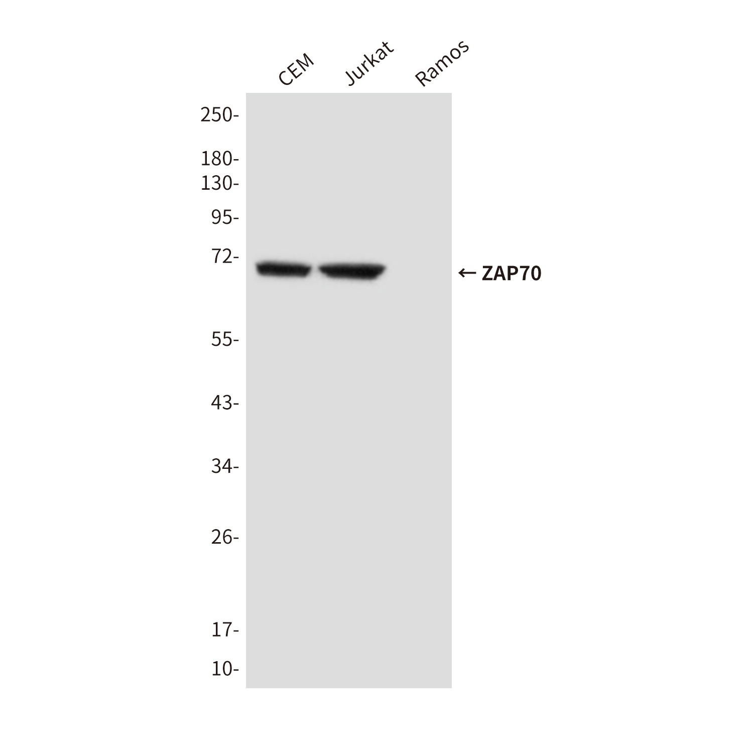 ZAP70 (4B2) Mouse mAb