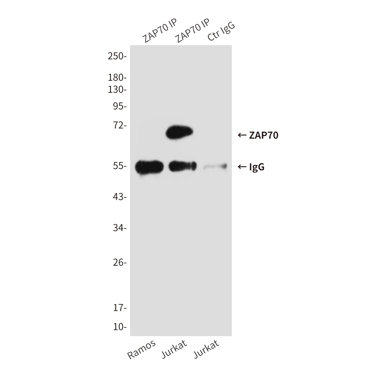 ZAP70 (4B2) Mouse mAb