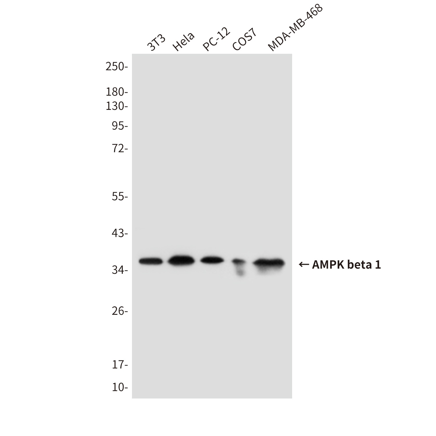 AMPK beta 1 (1A7) Mouse mAb