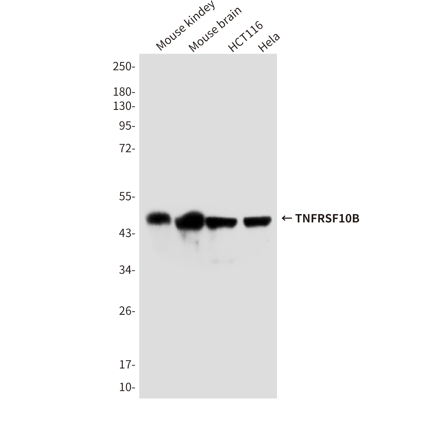 TNFRSF10B Antibody