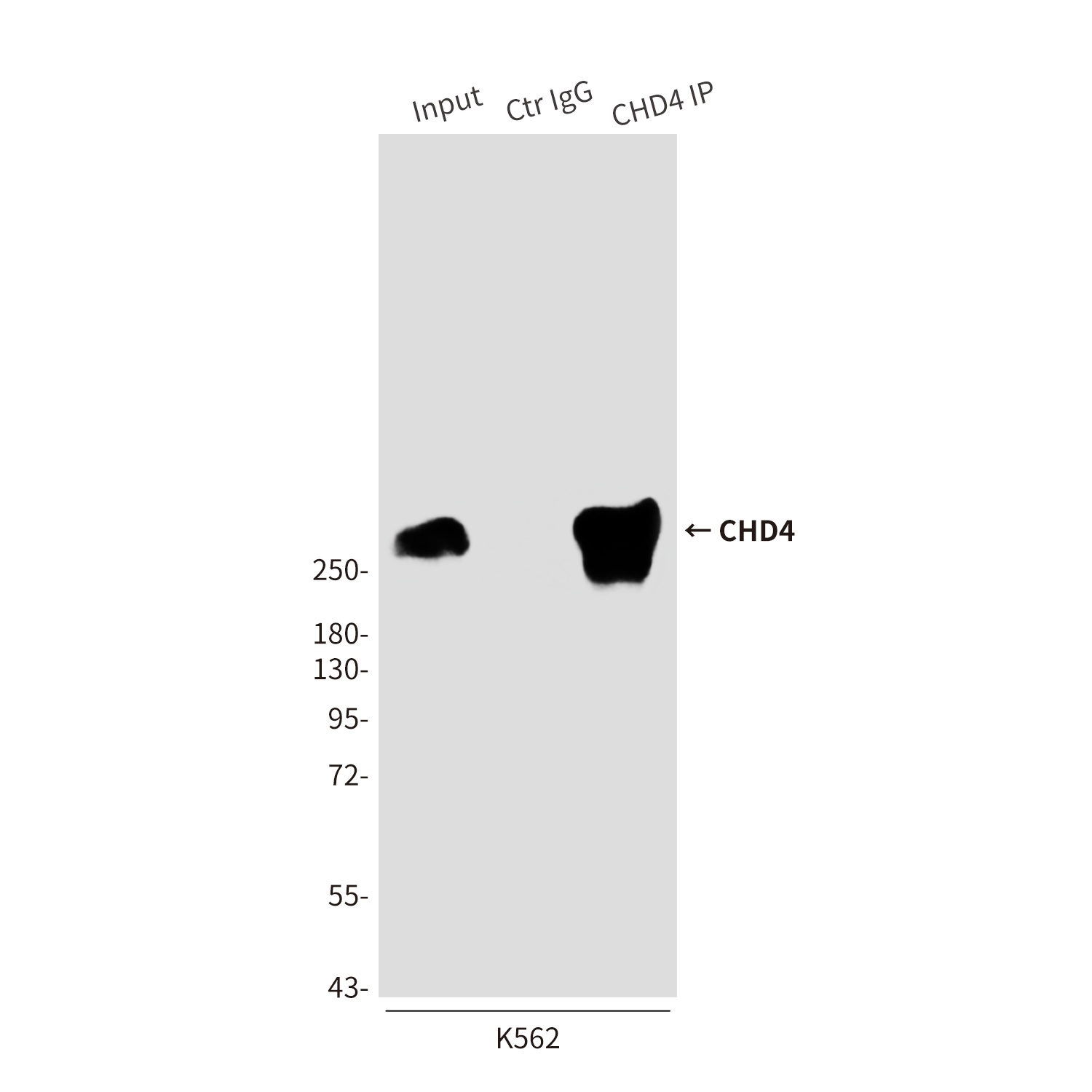 CHD4 (5F1) Mouse mAb