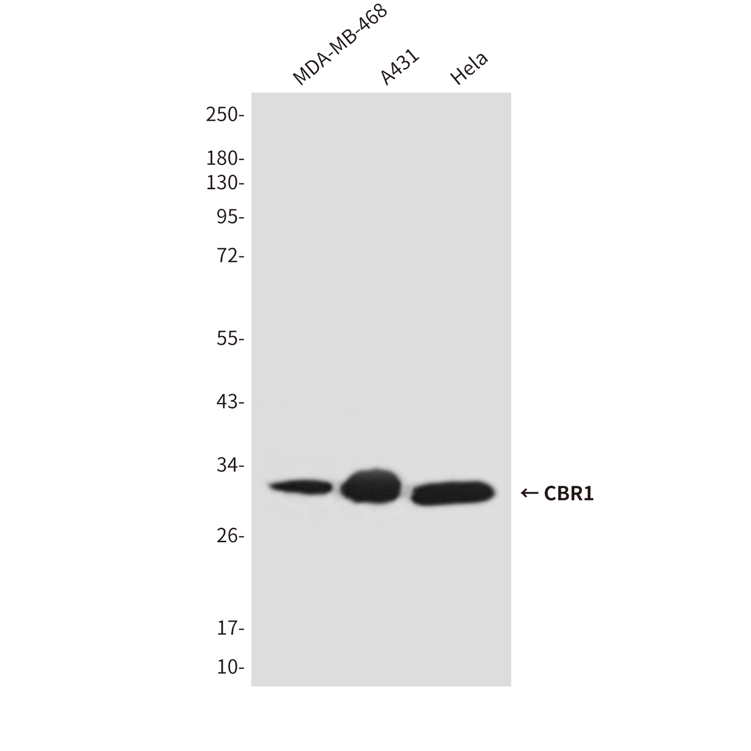 CBR1 Antibody
