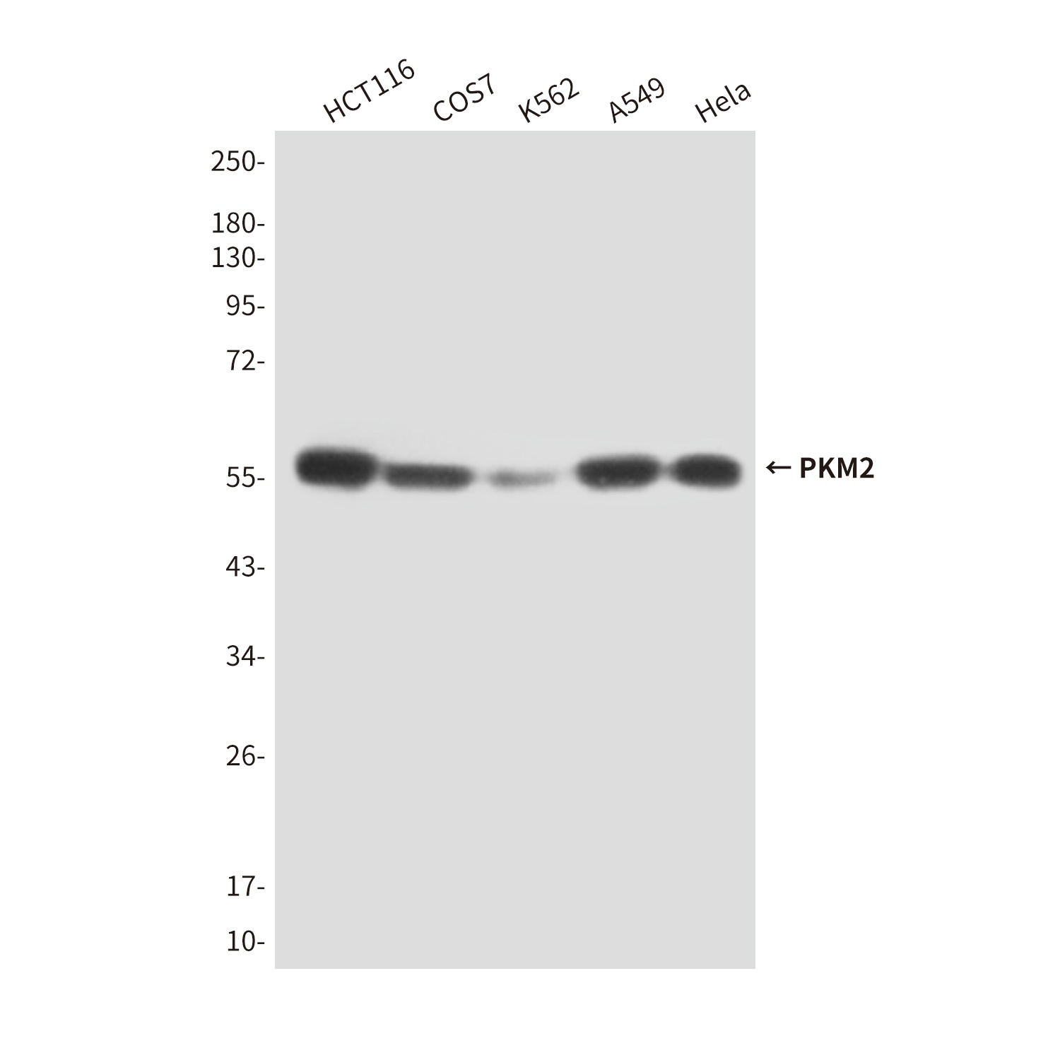 PKM2 (1F2) Mouse mAb