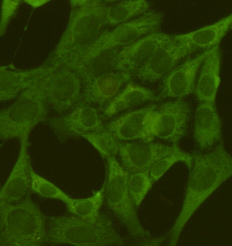 PKM2 (1F2) Mouse mAb