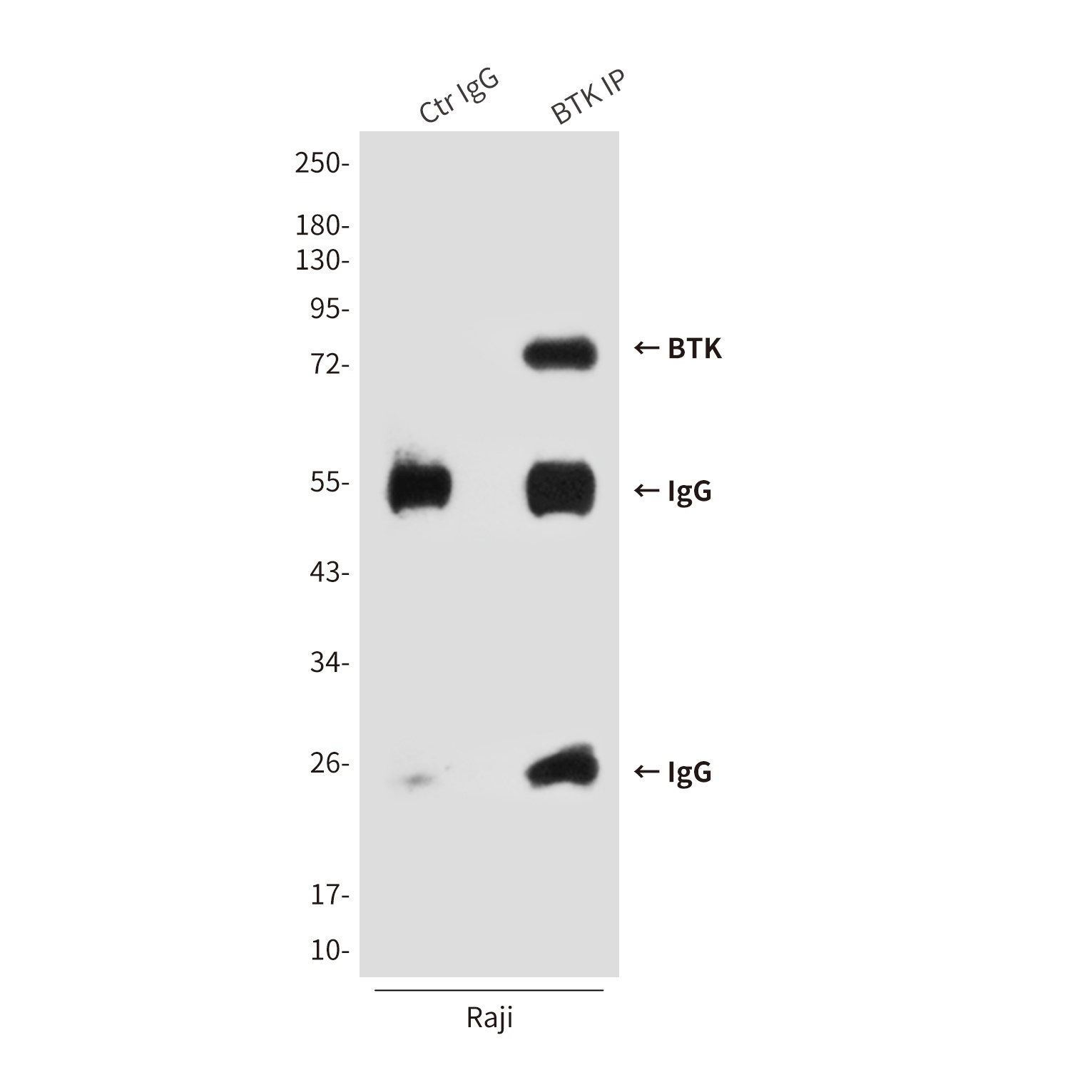 BTK (5B12) Mouse mAb