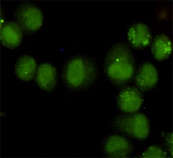 GTF2H1 (3E8) Mouse mAb