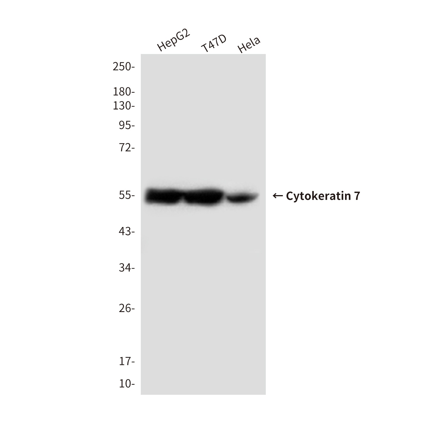 Cytokeratin 7 (4G9) Mouse mAb