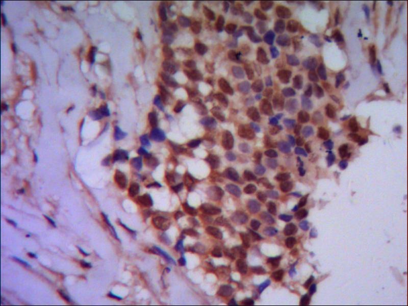 PPP4C (2F11) Mouse mAb