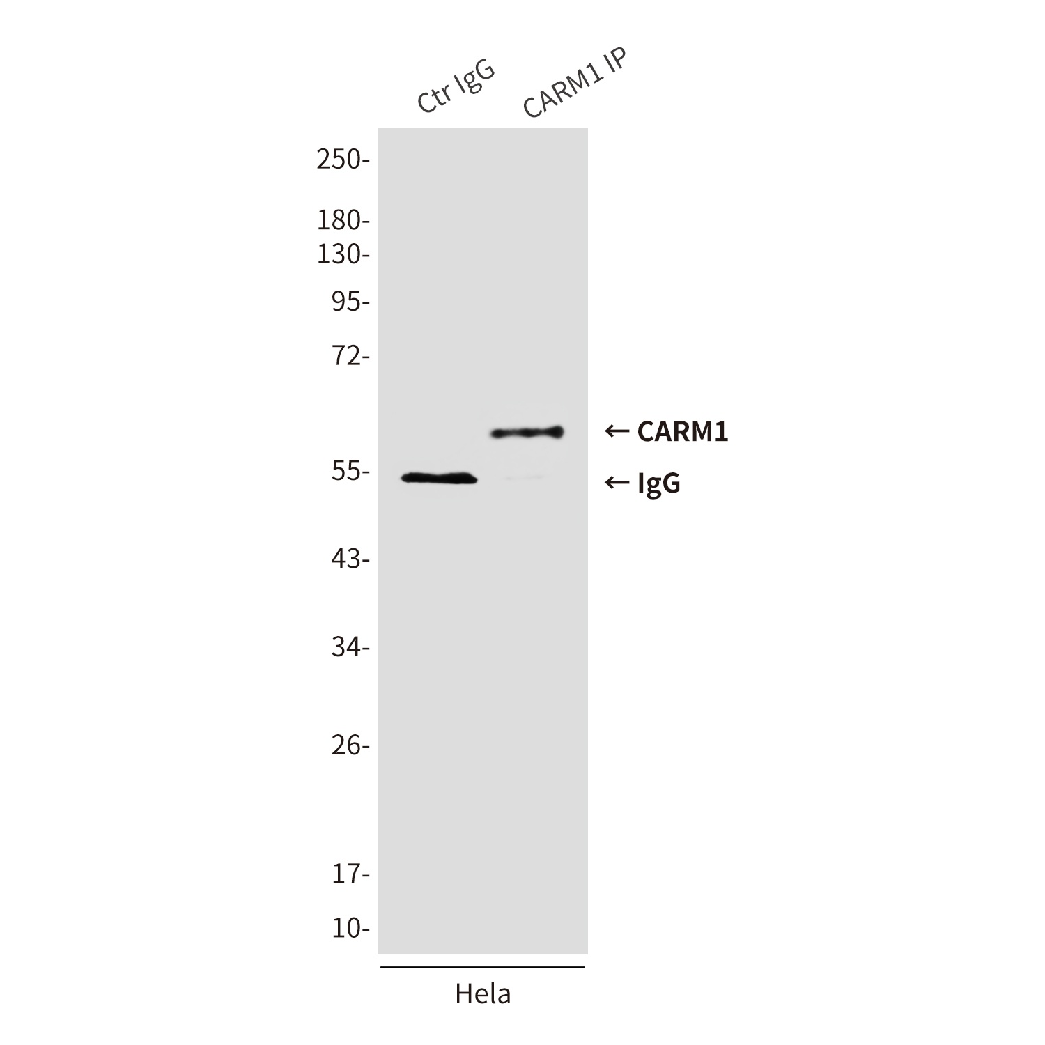 CARM1 (2B9) Mouse mAb