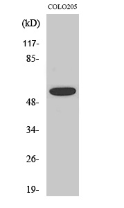 Phospho-AKT (Thr308) Rabbit pAb