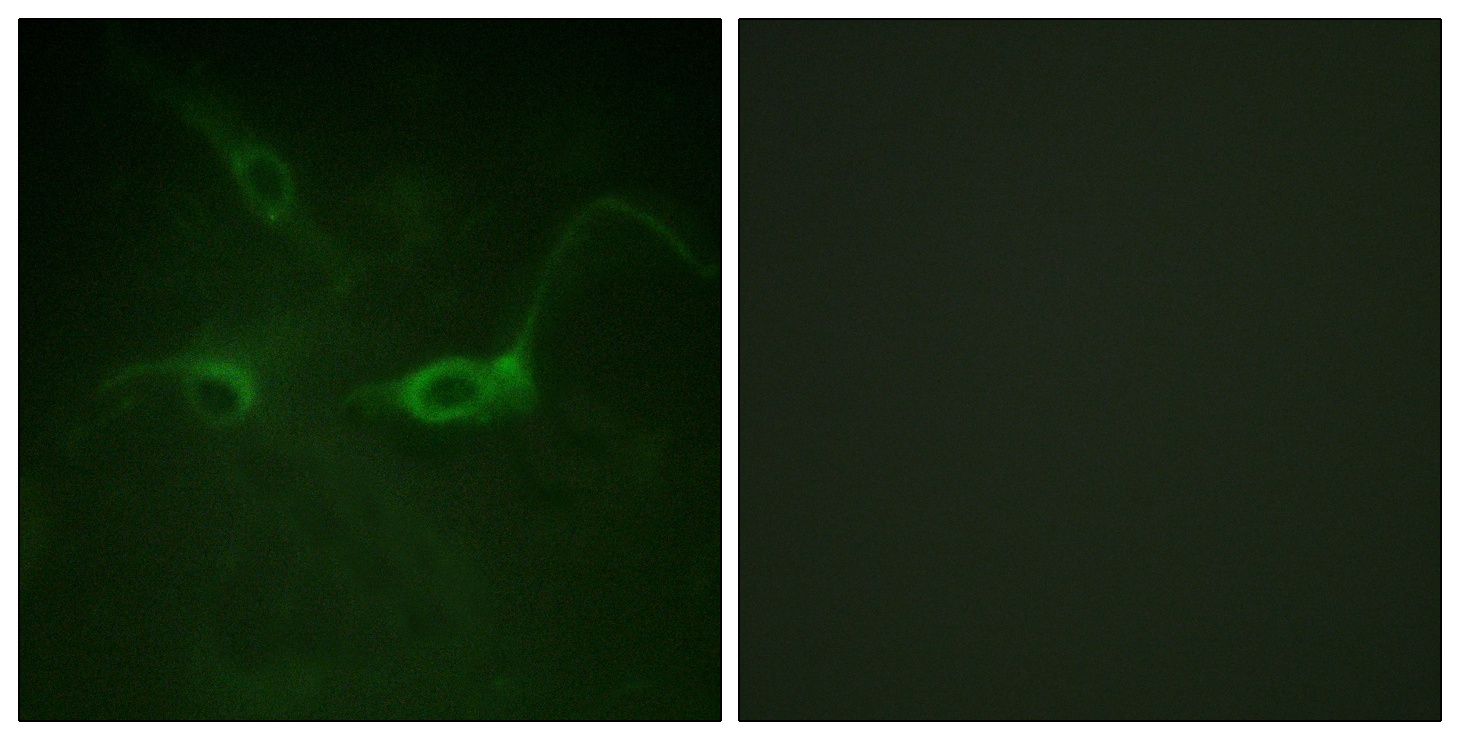 Phospho-FGFR1 (Tyr654) Rabbit pAb