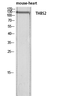 Thrombospondin 2 Rabbit pAb