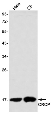 CRCP Rabbit mAb
