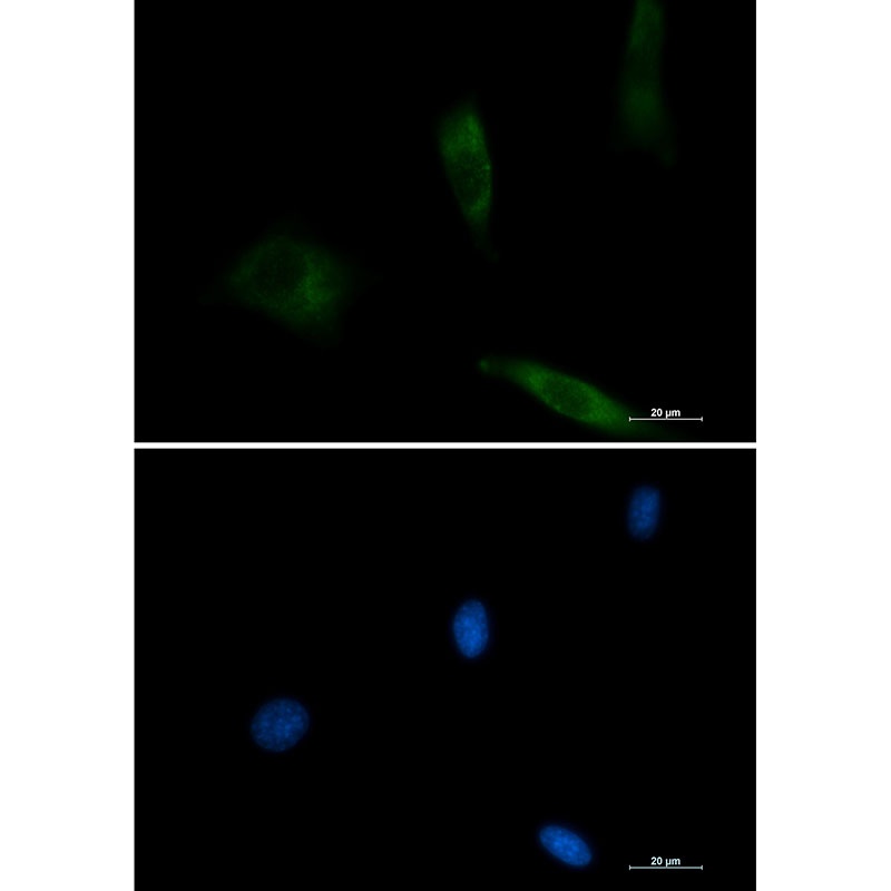 [KO] EGFR Rabbit mAb