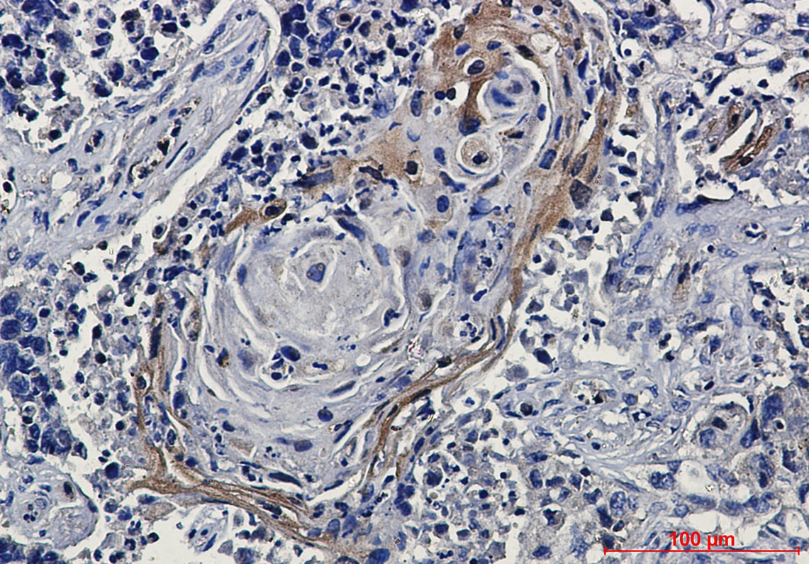 [KO] EGFR Rabbit mAb