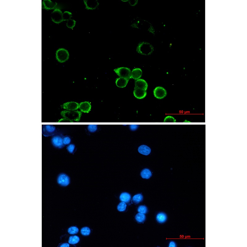 Adenosine A1 Receptor Rabbit mAb