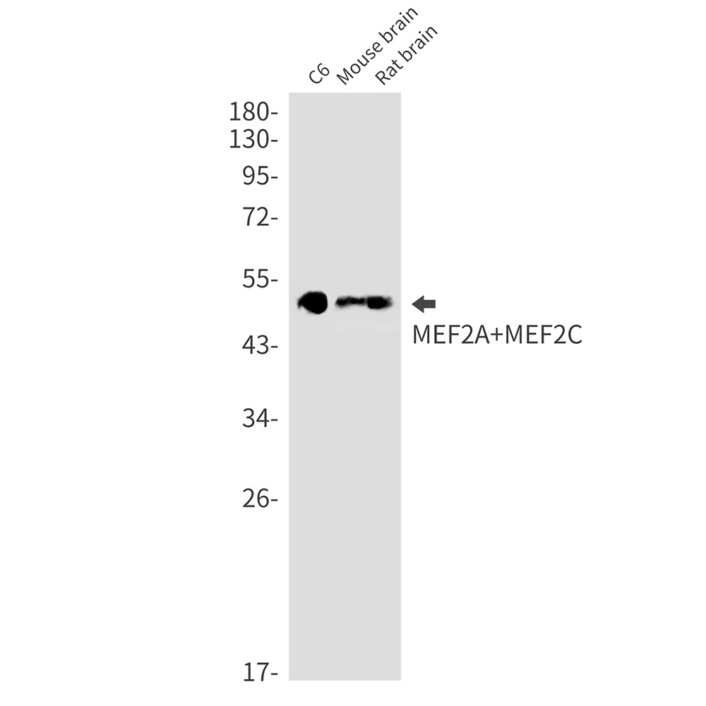 MEF2A/MEF2C Rabbit mAb