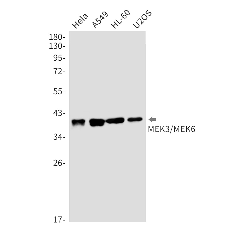 MEK3/MEK6 Rabbit mAb